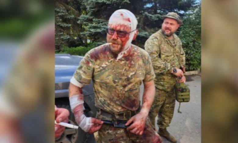 Były „członek” marionetkowych władz Doniecka zostaje ostrzelany w Donbasie